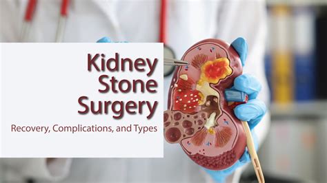 Can You Ejaculate a Kidney Stone? Exploring the Boundaries of Human Physiology and Imagination